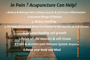 Benefits of Acupuncture for Pain Management